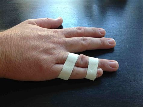 Learn How to Buddy Tape a Finger