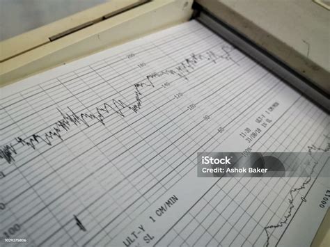 Cardiotocography Scan Printed Results Stock Photo - Download Image Now ...