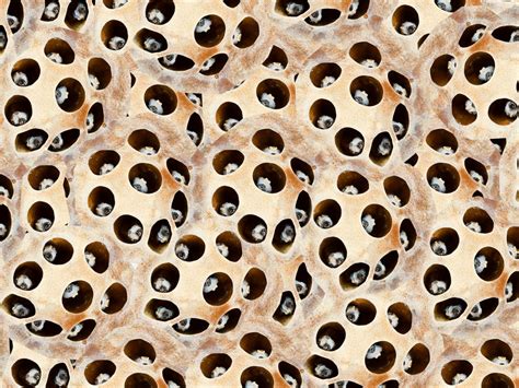 Trypophobia Meaning | What is trypophobia? All you need to know about the fear of small holes ...