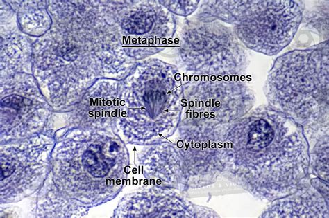 Metaphase Microscope