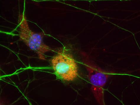 RNA FISH for neuroscience | LGC Biosearch Technologies