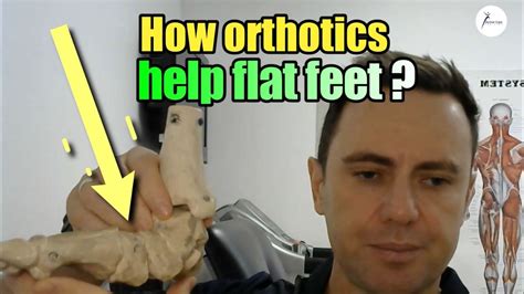 How Do Orthotics Help Flat Feet - Docpods Australia