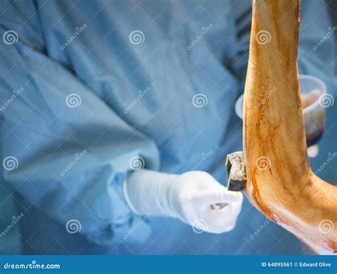 Elbow Injury Hospital Surgery Emergency Room Stock Image - Image of ...