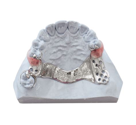 Cast Metal Partial Denture Reline or Rebase: Is It Worth It? - STOMADENT