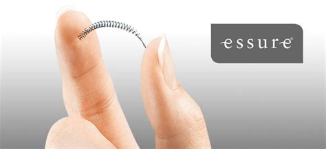 FDA Restricts Sales of Essure Birth Control Devices - 215.546.2604 Feldman & Pinto