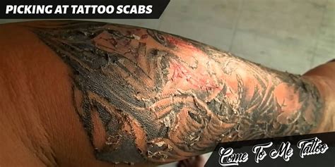 Tattoo Scarring: Causes and Ways to Minimize Scars | CTM-tattoo