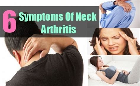 Cervical osteoarthritis or neck arthritis is a condition where the joints bones and discs in the ...