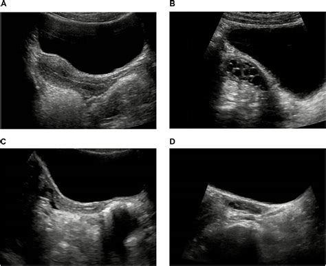 Normal Female Pelvic Ultrasound Images / Http Www Stritch Luc Edu Lumen Meded Obgyne Lectures Us ...