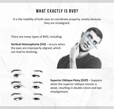 A Closer Look at Binocular Vision Dysfunction - Ms Mettle | Eye exercises, Vision problems ...