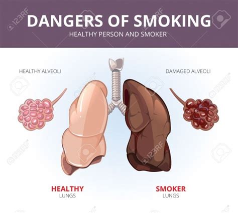 Diagram Of A Smokers Lungs