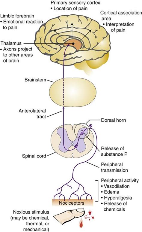 Pain | Basicmedical Key