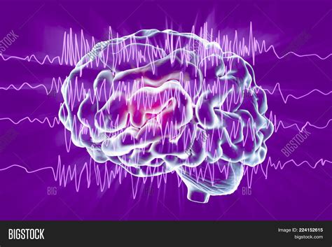 Epilepsy Awareness Image & Photo (Free Trial) | Bigstock