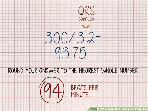 Ecg Heart Rate Calculation Formula - Photos Idea