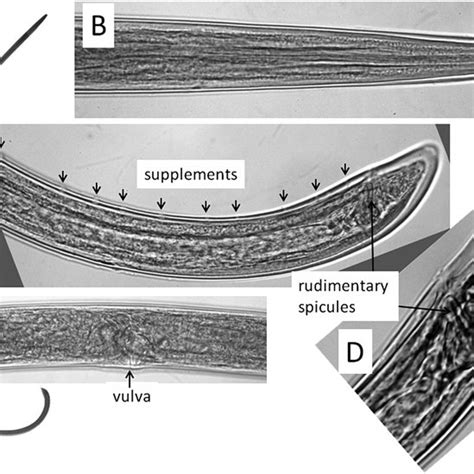 An intersex of Longidorus elongatus (A-D). A: Entire nematode; B:... | Download Scientific Diagram