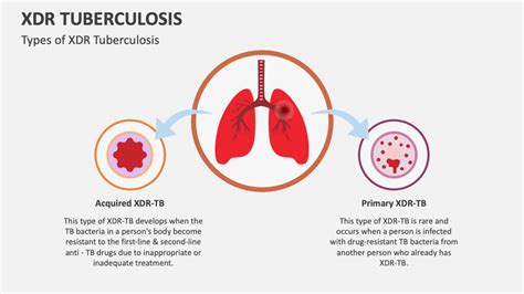 XDR Tuberculosis PowerPoint and Google Slides Template - PPT Slides