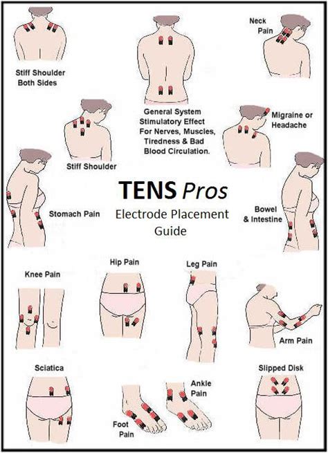 Tens Electrode Placement: What You Should Know