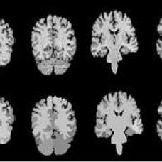 2: Using Splite and Merge algorithm for brain image segmentation[16] | Download Scientific Diagram