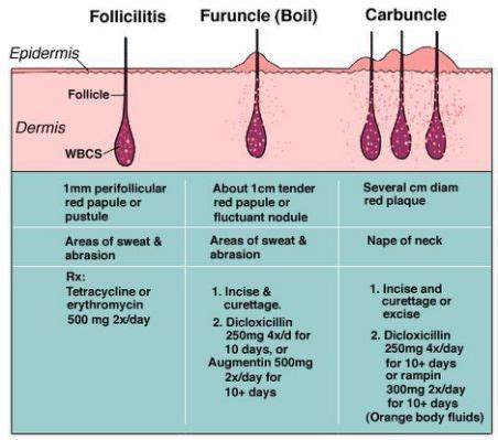 furuncle vs carbuncle - Google | Dermatology nurse, Keratosis pilaris, Dermatology