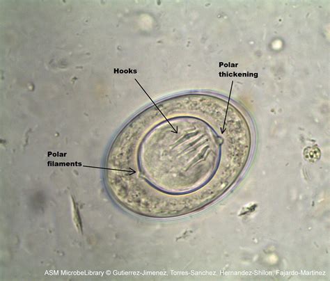 Hymenolepsis nana egg in 2021 | Medical laboratory, Medical laboratory ...