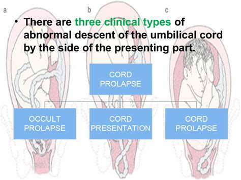 Cord prolapse