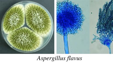 Aspergillus: Morphology, Clinical Features, and Lab Diagnosis • Microbe Online