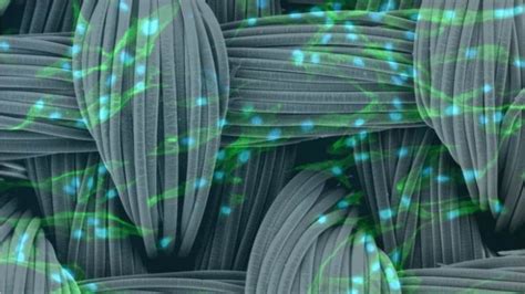 Researchers Create Artificial Muscle | Financial Tribune