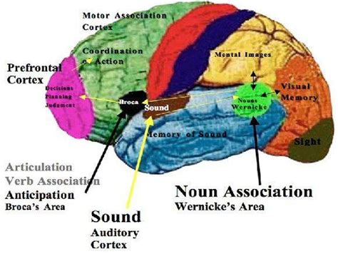 Pictures Of Broca's Motor Speech Area