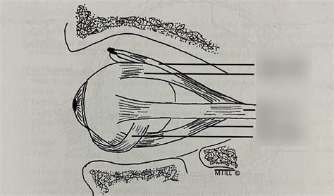 Extrinsic Eye Muscles Diagram | Quizlet