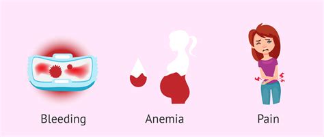 Symptoms of uterine polyps