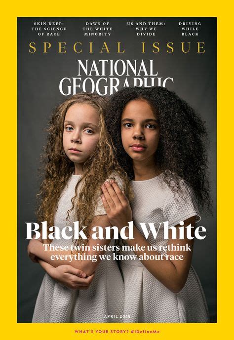 These Twins, One Black and One White, Will Make You Rethink Race — National Geographic ...