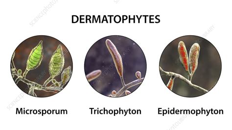 Dermatophyte fungi, illustration - Stock Image - F036/7209 - Science Photo Library