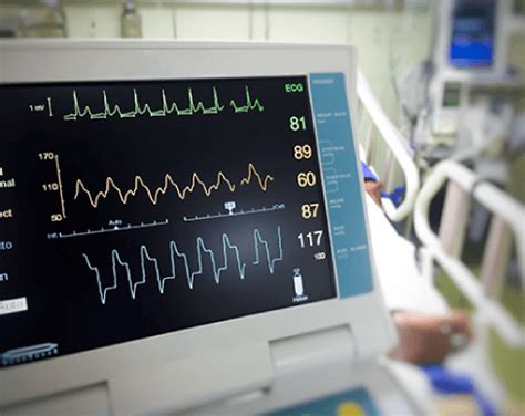 Cardiac Arrhythmia Management - South Tampa Cardiology