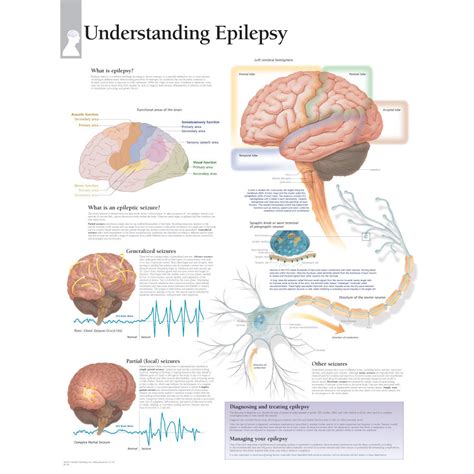 Scientific Publishing Understanding Epilepsy Chart