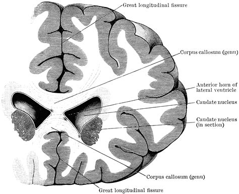 Section Through Lateral Ventricles | ClipArt ETC