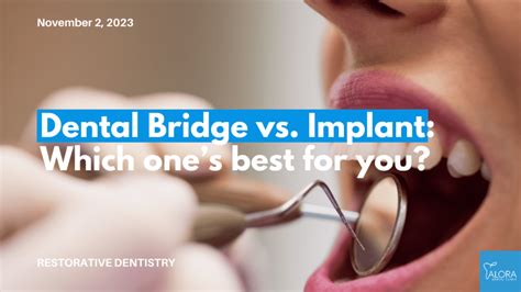 Dental Bridge vs. Implant: Which is Best for Your Smile?