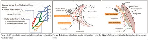 Peripheral nerve stimulator guided pectoralis (PEC-I) block: A novel approach to the chest wall ...