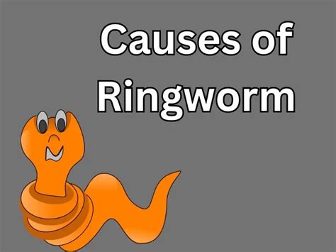 Ringworm: Things to know about the Skin Infection