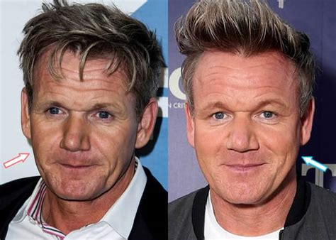 Gordon Ramsay: BEFORE and AFTER 2022