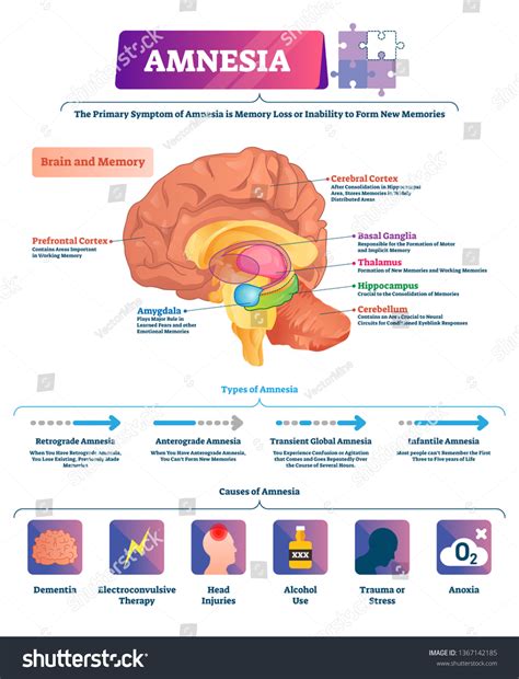 Brain Memory Diagram