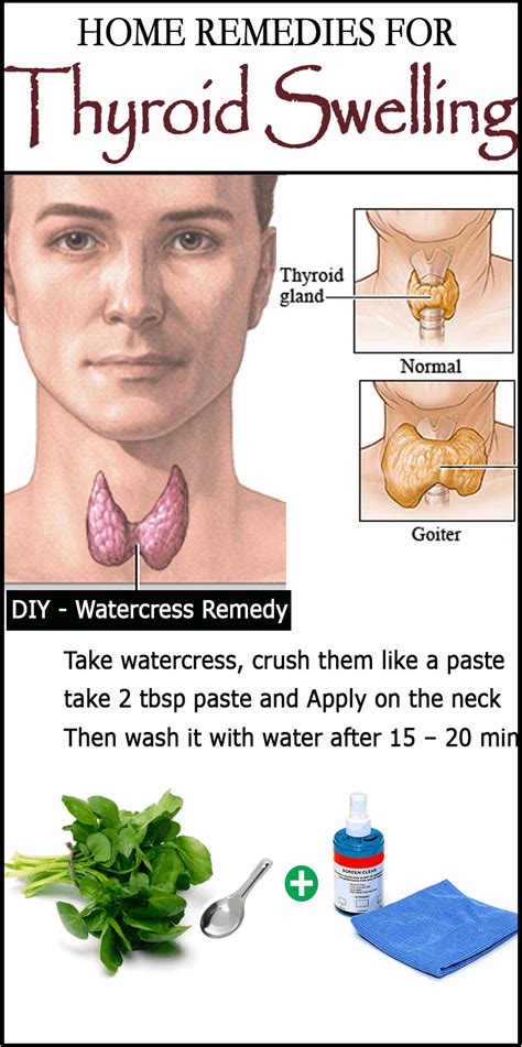 DIY Remedies For Goiter (Thyroid Swelling)