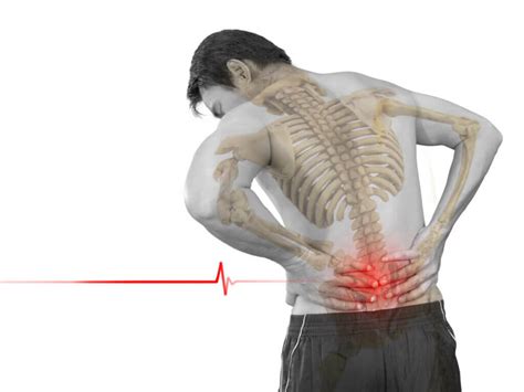 Causes of Lumbar Hyperlordosis - Fit People