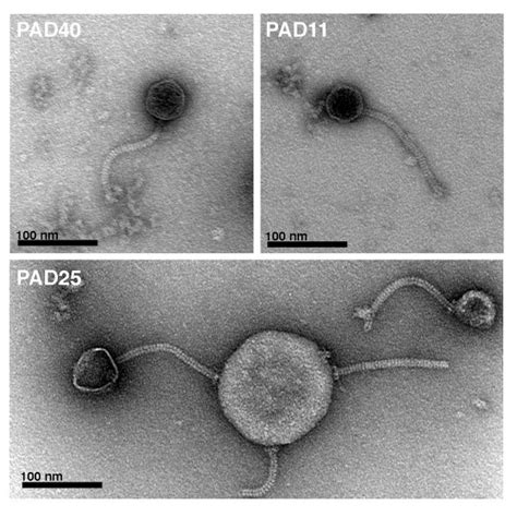 Electron micrographs of bacteriophages from P. acnes. Phages were ...