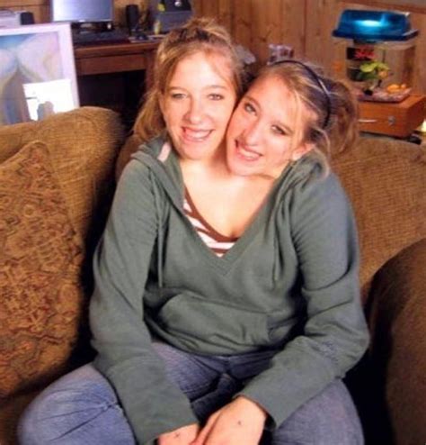 30 Fun Things About Conjoined Twins Abby and Brittany Hensel - The Frisky