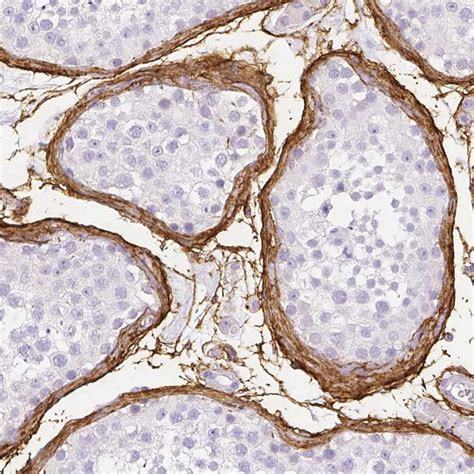 Fibrillin 1 Antibody (PA5-82743)