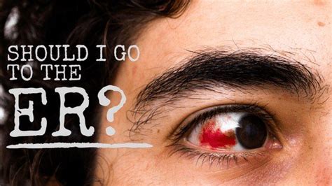 Should I Go To The Emergency Room If My Eye Hurts?