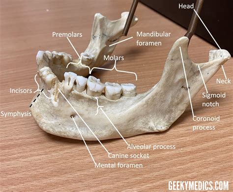 Mandibular Fractures | Anatomy, Management | Geeky Medics