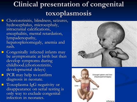 Toxoplasmosis Birth Defects