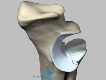 How To Treat Elbow Dysplasia In Dogs