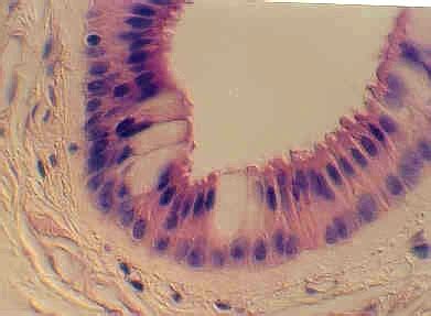 STRATIFIED COLUMNAR OR CUBOIDAL EPITHELIUM | Microanatomy Web Atlas | Gwen V. Childs, Ph.D.