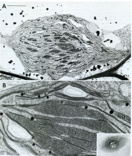 (A) Electron micrograph of a chloroplast of Sphaerosporoceros... | Download Scientific Diagram